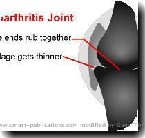 pain from osteoarthritis