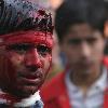 Muharram procession in Srinagar
Kashmiri Shi'ite Muslim bleeding during a Muharram procession in Srinagar December 28, 2009. Muslims all over the world mourn the slaying of Imam Hussein, grandson of Prophet Mohammad, during the first ten days of the Islamic month of Muharram. Imam Hussein was killed by his political rivals along with 72 companions in Iraq some 1,300 years ago..