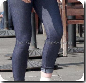 Sophie Monk walking in Hollywood with a foot cast after her recent car accident in Marina del Rey. She is also wearing a back brace and had much difficulty walking due to her injuries. Los Angeles.