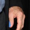 Harrison Ford leaves Ciprianis with a blue bandage on his left thumb London.