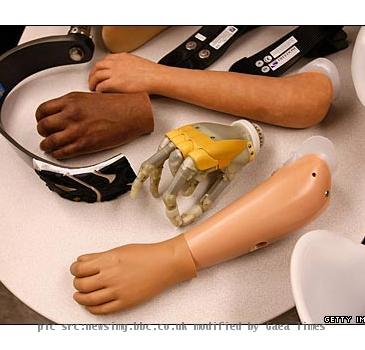 Prosthetic limbs