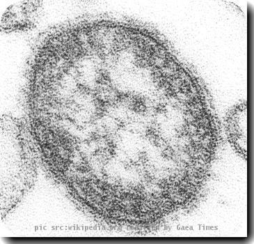 Measles_virus_59283_O