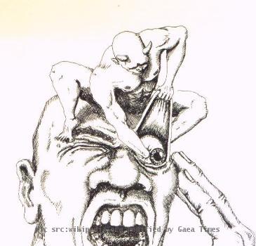 Drawing "THE CLUSTER HEADACHE"