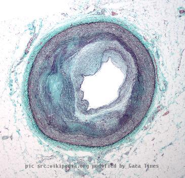 Low magnification wMicrograph