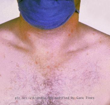 updated high res version from CDC-PHIL. Includes EXIF info