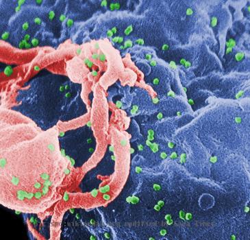 Scanning electron micrograph of HIV-1 budding from cultured lymphocyte. See PHIL 1197 for a black and white view of this image.