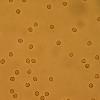 Microscopic hematuria Red blood cells in a urine sample seen under the microscope.