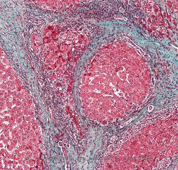 High magnification wMicrograph