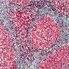 High magnification wMicrograph