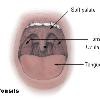 Diagram of the palatine tonsils from U.S. National Cancer Institute web site Uploaded on 18 December 2004 from U.S. National Cancer Institute trai