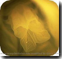 The Mouth and Manubrium of a Cubozoan