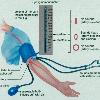 A Better Blood Pressure Reading Get a more accurate reading by following these simple steps  Next time your doctor takes your blood pressure  make sure your arm is bent at the elbow and your