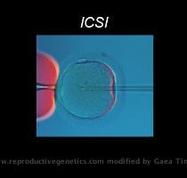 inserts a single sperm into each egg  This is done by perforating the membrane of the egg with a glass pipette  which contains the sperm and it requires highly developed skills  Because only one sperm is needed per egg  fertilization is made possible through ICSI even when only a few sperm are available  This becomes especially important in males with azoospermia