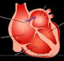 za?lenit do sv� profesn� pr�ce  Byla mezi nimi ?ada zku?en�ch kardiolog?  proto jsme se logicky zam??ili na vliv otev?en�ho foramen ovale  PFO  na pot�p??e  Co je to PFO  V pr?b?hu nitrod?lo?n�ho v�voje plod nepot?ebuje d�chat  Okysli?en� krev je p?iv�d?na z placenty   matka d�ch� i za sv� d�t?  Pl�ce jsou  zmuchlan�  uvnit? hrudn�ku a