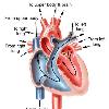 Patent Foramen Ovale  PFO  One of the most significant predisposing risk factors in DCS is a physical abnormality of the heart called Patent Foramen Ovale  PFO    a small opening between the upper two chambers of the