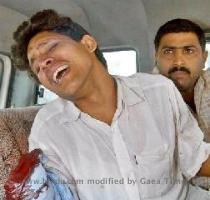 Violent India The high cost of democracy   a youth who lost his hand when a bomb exploded at a polling station in Bakhtiyarpur  Bihar on Tuesday  Photo by  AP