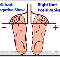 foot is positively skewed  The  skew  part of a graph is the smaller part of the curve  so your little toe is the skew part  The answer to skew questions is right under your   whole body