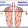 foot is positively skewed  The  skew  part of a graph is the smaller part of the curve  so your little toe is the skew part  The answer to skew questions is right under your   whole body