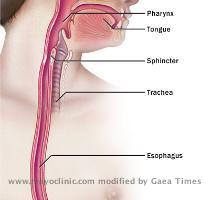 Trouble swallowing Swallowing problems  dysphagia  can occur anywhere along the path from your mouth to your stomach  IM01645