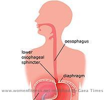 Heartburn Heartburn is a burning sensation in the chest that can extend to the neck  throat  and face  it is worsened by bending or lying down  It is the primary symptom of